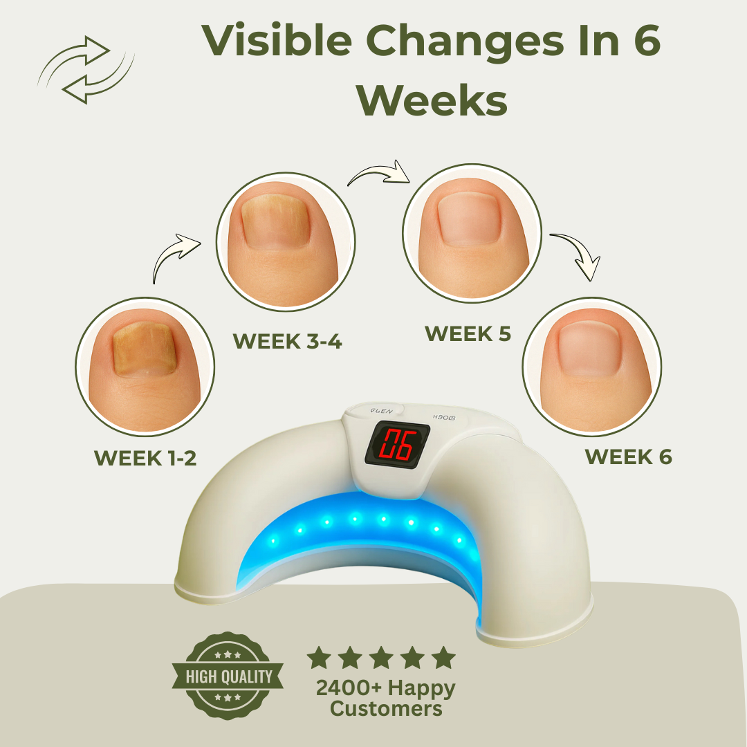 LAZRON - Fungus Care Laser Device